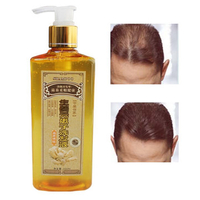 Ginger Anti Hair Loss Shampoo Shedding Alopecia Proof Growth Nourish Scalp Treatment