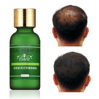 Natural Plant Pure Extract Rapid Hair Growth Essence Essential Oil Liquid Ginseng Ginger Herbal