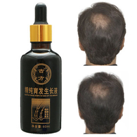 Shedding Proof Herbal Extract Liquid Hair Growth Anti Loss Activating Repair Men Women 60ml